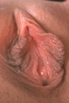 Big Pussy Lips Large Labia Huge Vagina Gaping